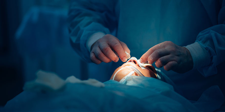 closed open rhinoplasty